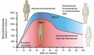 Osteoporose: Verlauf der Knochendichte mit zunehmendem Alter