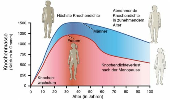 Was ist Osteoporose und was kann man tun? | hiro